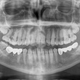 Illustration for article titled Steps Followed For The Best Orthodontic treatment Process At Growing Smiles